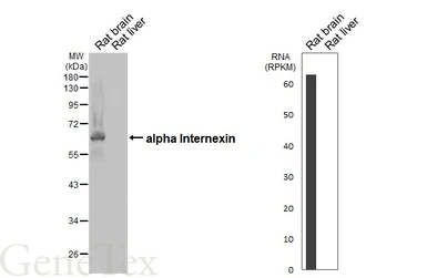 Anti-alpha Internexin antibody [HL5916] used in Western Blot (WB). GTX647241