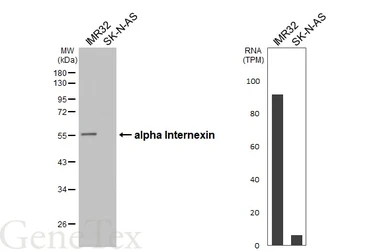 Anti-alpha Internexin antibody [HL5916] used in Western Blot (WB). GTX647241