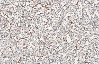 Anti-Fibrinogen alpha antibody [HL5932] used in IHC (Paraffin sections) (IHC-P). GTX647257