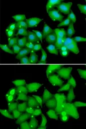 Anti-Sts1 antibody used in Immunocytochemistry/ Immunofluorescence (ICC/IF). GTX64736