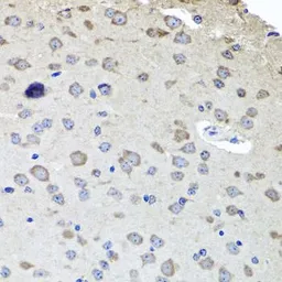Anti-AChR beta 2 antibody used in IHC (Paraffin sections) (IHC-P). GTX64742