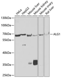 Anti-ALG1 antibody used in Western Blot (WB). GTX64746