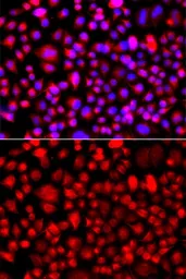 Anti-ALG1 antibody used in Immunocytochemistry/ Immunofluorescence (ICC/IF). GTX64746