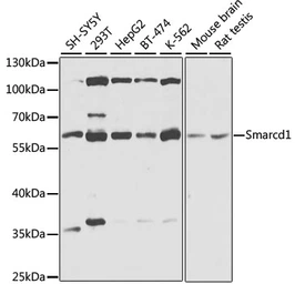Anti-SMARCD1 antibody used in Western Blot (WB). GTX64747