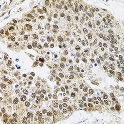 Anti-SMARCD1 antibody used in IHC (Paraffin sections) (IHC-P). GTX64747