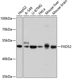 Anti-FADS2 antibody used in Western Blot (WB). GTX64748