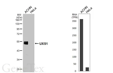 Anti-UXS1 antibody [HL5946] used in Western Blot (WB). GTX647558