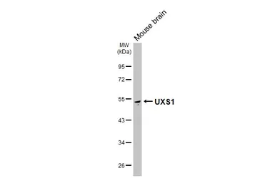 Anti-UXS1 antibody [HL5946] used in Western Blot (WB). GTX647558