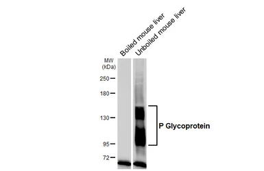 Anti-P Glycoprotein antibody [GT391] used in Western Blot (WB). GTX647572