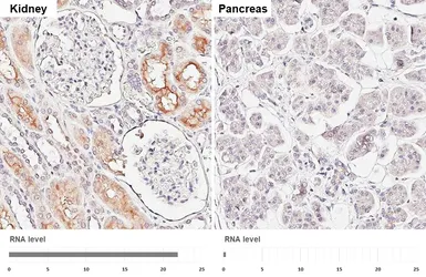 Anti-P Glycoprotein antibody [GT391] used in IHC (Paraffin sections) (IHC-P). GTX647572