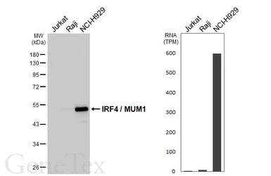 Anti-IRF4 / MUM1 antibody [HL5982] used in Western Blot (WB). GTX647596