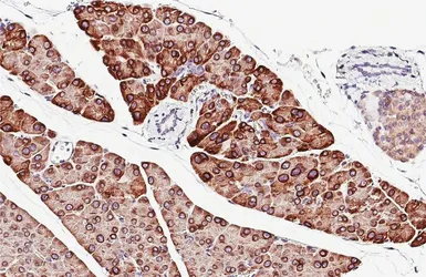 Anti-SEC61B antibody [HL5984] used in IHC (Paraffin sections) (IHC-P). GTX647598