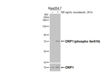 Anti-DRP1 (phospho Ser616) antibody [HL5985] used in Western Blot (WB). GTX647599