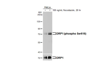 Anti-DRP1 (phospho Ser616) antibody [HL5985] used in Western Blot (WB). GTX647599