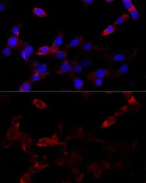 Anti-CYP1B1 antibody used in Immunocytochemistry/ Immunofluorescence (ICC/IF). GTX64767