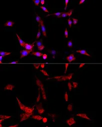 Anti-CYP1B1 antibody used in Immunocytochemistry/ Immunofluorescence (ICC/IF). GTX64767