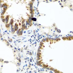 Anti-C8orf4 antibody used in IHC (Paraffin sections) (IHC-P). GTX64775