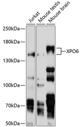 Anti-XPO6 antibody used in Western Blot (WB). GTX64781