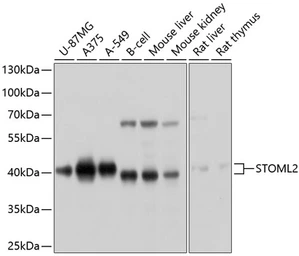 Anti-STOML2 antibody used in Western Blot (WB). GTX64801