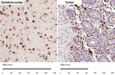 Anti-PSAP antibody [HL6003] used in IHC (Paraffin sections) (IHC-P). GTX648077