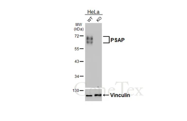 Anti-PSAP antibody [HL6003] used in Western Blot (WB). GTX648077