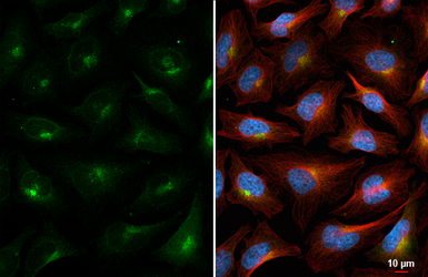 Anti-PSAP antibody [HL6003] used in Immunocytochemistry/ Immunofluorescence (ICC/IF). GTX648077