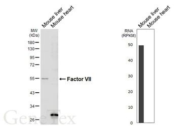 Anti-Factor VII antibody [HL6005] used in Western Blot (WB). GTX648079