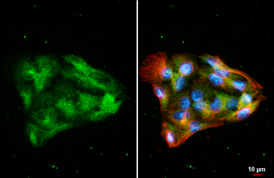 Anti-Factor VII antibody [HL6005] used in Immunocytochemistry/ Immunofluorescence (ICC/IF). GTX648079