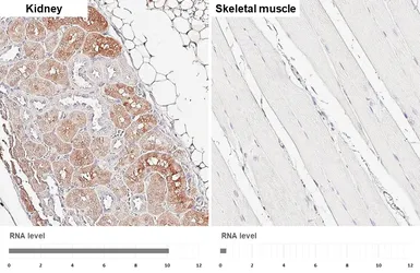 Anti-PHGDH antibody [HL6006] used in IHC (Paraffin sections) (IHC-P). GTX648080