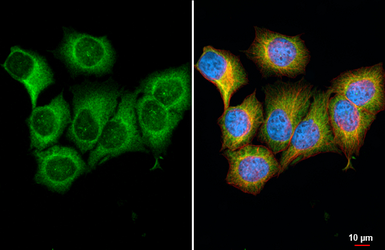 Anti-PHGDH antibody [HL6006] used in Immunocytochemistry/ Immunofluorescence (ICC/IF). GTX648080