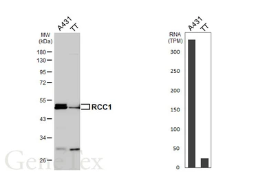 Anti-RCC1 antibody [HL6010] used in Western Blot (WB). GTX648084