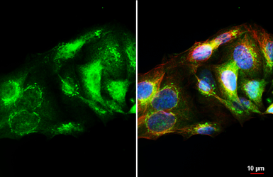 Anti-p40 antibody [HL6013] used in Immunocytochemistry/ Immunofluorescence (ICC/IF). GTX648087