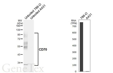Anti-CD70 antibody [HL6015] used in Western Blot (WB). GTX648089