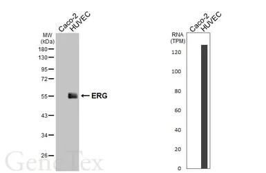 Anti-ERG antibody [HL6016] used in Western Blot (WB). GTX648090