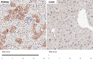Anti-PHGDH antibody [HL6028] used in IHC (Paraffin sections) (IHC-P). GTX648102