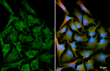 Anti-PHGDH antibody [HL6028] used in Immunocytochemistry/ Immunofluorescence (ICC/IF). GTX648102