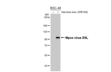 Anti-Mpox virus E9L antibody [GT397] used in Western Blot (WB). GTX648116