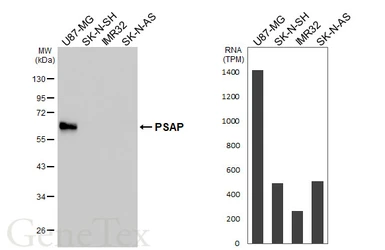 Anti-PSAP antibody [HL6041] used in Western Blot (WB). GTX648120