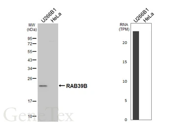 Anti-RAB39B antibody [HL6060] used in Western Blot (WB). GTX648139