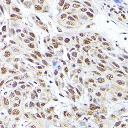 Anti-SEC14L2 antibody used in Immunocytochemistry/ Immunofluorescence (ICC/IF). GTX64814