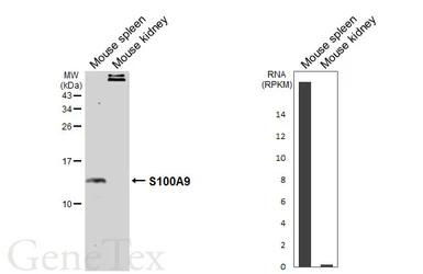 Anti-S100A9 antibody [HL6069] used in Western Blot (WB). GTX648148