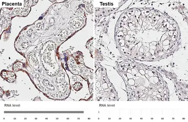 Anti-Cytokeratin 7 antibody [HL6074] used in IHC (Paraffin sections) (IHC-P). GTX648153