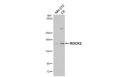 Anti-ROCK2 antibody [HL6079] used in Western Blot (WB). GTX648158