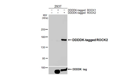 Anti-ROCK2 antibody [HL6079] used in Western Blot (WB). GTX648158