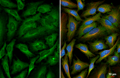 Anti-ROCK2 antibody [HL6079] used in Immunocytochemistry/ Immunofluorescence (ICC/IF). GTX648158