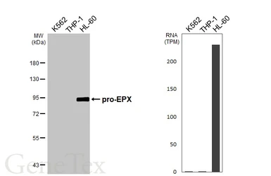 Anti-EPX antibody [HL6083] used in Western Blot (WB). GTX648162