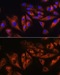 Anti-ATXN10 antibody used in Immunocytochemistry/ Immunofluorescence (ICC/IF). GTX64818