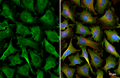 Anti-RAB7L1 antibody [HL6105] used in Immunocytochemistry/ Immunofluorescence (ICC/IF). GTX648190