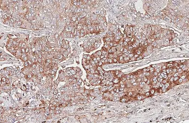 Anti-Napsin A antibody [HL6114] used in IHC (Paraffin sections) (IHC-P). GTX648199