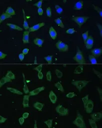 Anti-EIF3D antibody used in Immunocytochemistry/ Immunofluorescence (ICC/IF). GTX64820